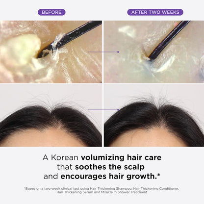 Doctor G. Thickening Serum, Shampoo, Conditioner, and Scalp Treatment Set for Hair Loss