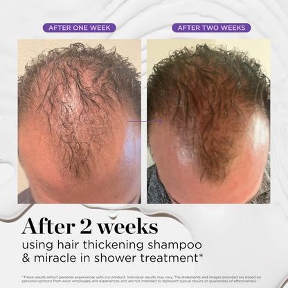 Doctor G. Miracle in Shower Treatment